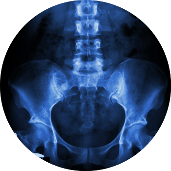 hip x-ray image tyler welch md